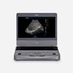 Acclarix AX8 Ultrasound System